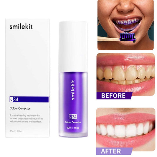 SMILEKIT™ - Für ein strahlendes Lächeln